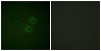 DNAM-1 (phospho Ser329) rabbit pAb Antibody