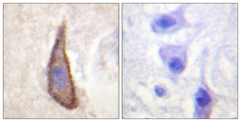 DNAM-1 (phospho Ser329) rabbit pAb Antibody