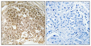 MRG15 rabbit pAb Antibody