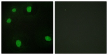 MRG15 rabbit pAb Antibody