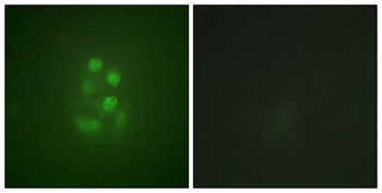 KIF2C (phospho Ser95) rabbit pAb Antibody