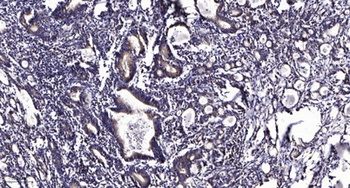 KIF2C (phospho Ser95) rabbit pAb Antibody