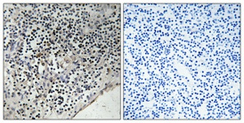 Cdc37 (phospho Ser13) rabbit pAb Antibody