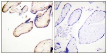 Cdc37 (phospho Ser13) rabbit pAb Antibody