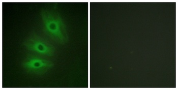 A Cyclase V/VI rabbit pAb Antibody