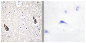 A Cyclase V/VI rabbit pAb Antibody