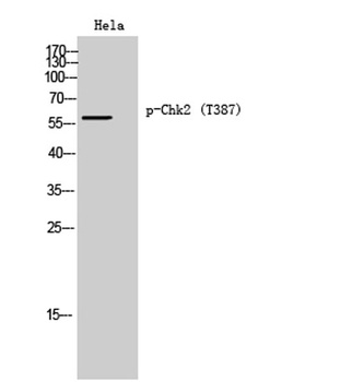 Chk2 (phospho Thr387) rabbit pAb Antibody