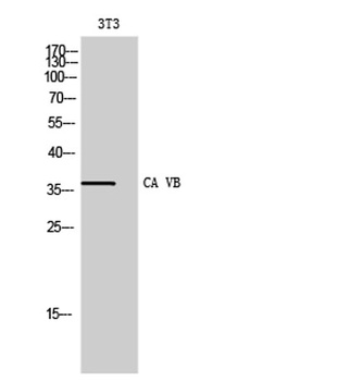 CA VB rabbit pAb Antibody