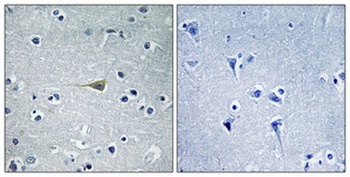 CA VB rabbit pAb Antibody