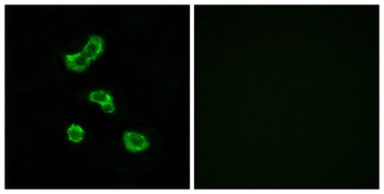 CA VB rabbit pAb Antibody