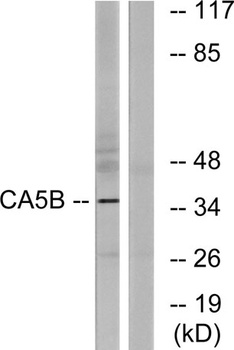 CA VB rabbit pAb Antibody