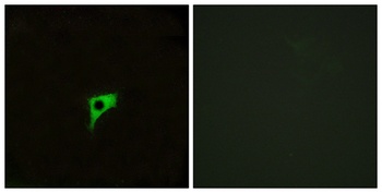 mAChR M2 rabbit pAb Antibody