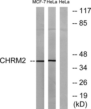 mAChR M2 rabbit pAb Antibody
