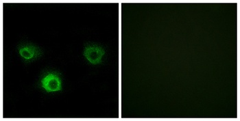 CKR-4 rabbit pAb Antibody