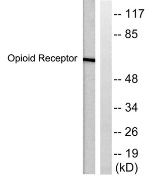 CKR-5 rabbit pAb Antibody