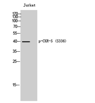 CKR-5 (phospho Ser336) rabbit pAb Antibody