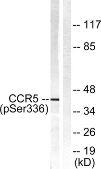 CKR-5 (phospho Ser336) rabbit pAb Antibody