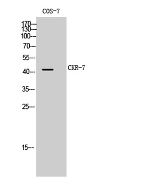 CKR-7 rabbit pAb Antibody