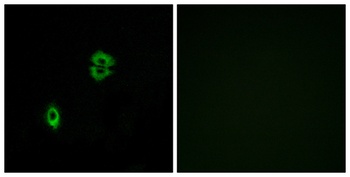CKR-7 rabbit pAb Antibody