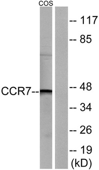 CKR-7 rabbit pAb Antibody
