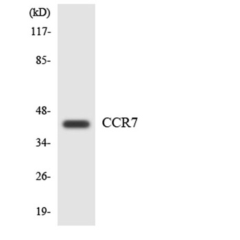 CKR-7 rabbit pAb Antibody