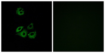 Chemokine Receptor D6 rabbit pAb Antibody