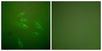 COL3A1 rabbit pAb Antibody