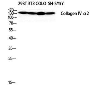 COL4A2 rabbit pAb Antibody