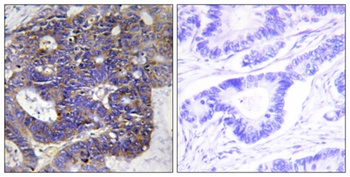 COL4A2 rabbit pAb Antibody