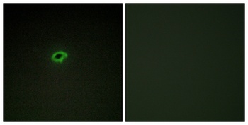 COL4A4 rabbit pAb Antibody