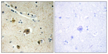 COL4A4 rabbit pAb Antibody