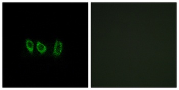 Cystatin L1 rabbit pAb Antibody