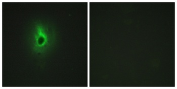COL6A3 rabbit pAb Antibody