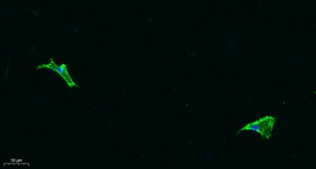 COL11A1 rabbit pAb Antibody