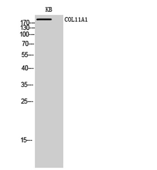 COL11A1 rabbit pAb Antibody