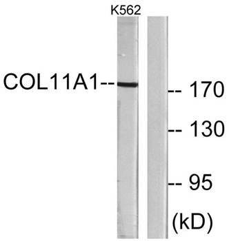 COL11A1 rabbit pAb Antibody