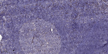COL11A1 rabbit pAb Antibody