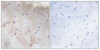 COL12A1 rabbit pAb Antibody