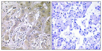 ACOT12 rabbit pAb Antibody