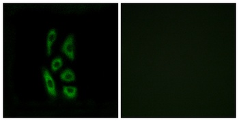 ACOT12 rabbit pAb Antibody