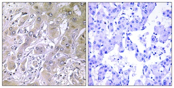 ACOT12 rabbit pAb Antibody
