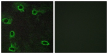 Adenosine A2A-R rabbit pAb Antibody