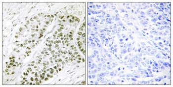 ATF-2 (phospho Ser480) rabbit pAb Antibody