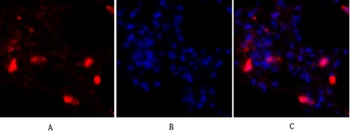 p38 rabbit pAb Antibody