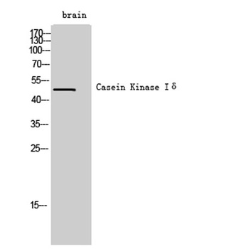 Casein Kinase Iδ rabbit pAb Antibody