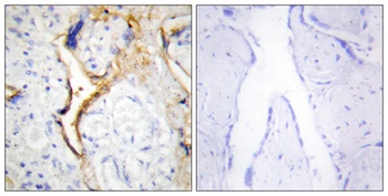 Casein Kinase Iε rabbit pAb Antibody
