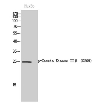 Casein Kinase IIβ (phospho Ser209) rabbit pAb Antibody