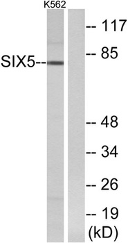 Six5 rabbit pAb Antibody