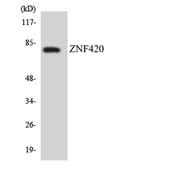 ZNF420 rabbit pAb Antibody