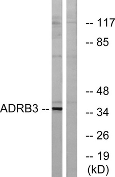 AR-β3 rabbit pAb Antibody